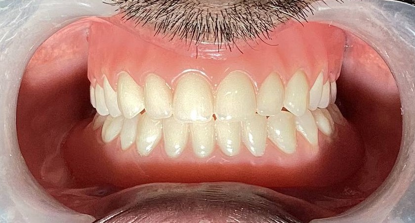 Clinical Case Image