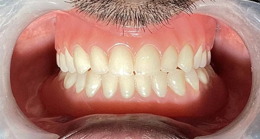 Lakshmi Smiles dental treatment case image
