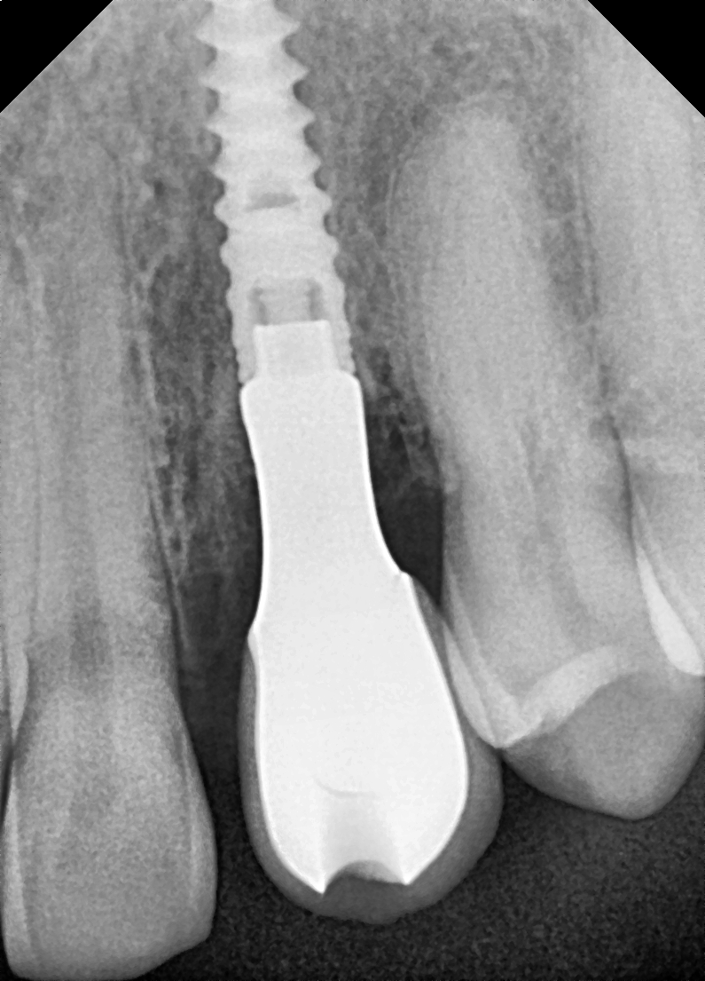 Clinical Case Image