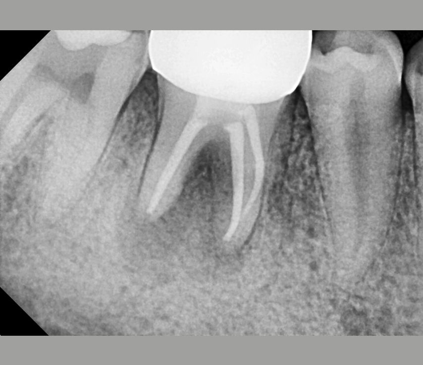 Clinical Case Image