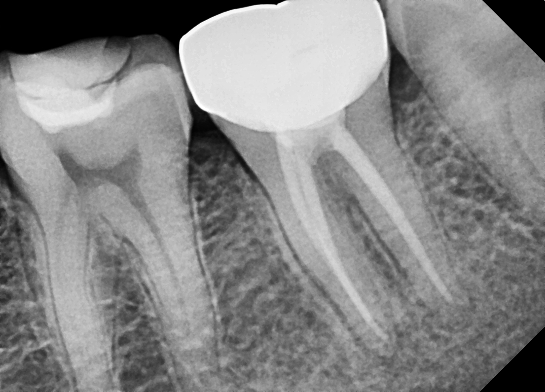 Clinical Case Image